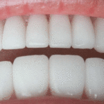 Gifs de dente